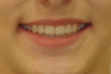 Naše výsledky